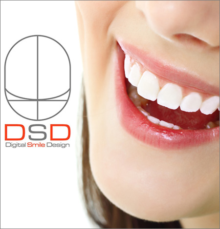 Digital Smile Design